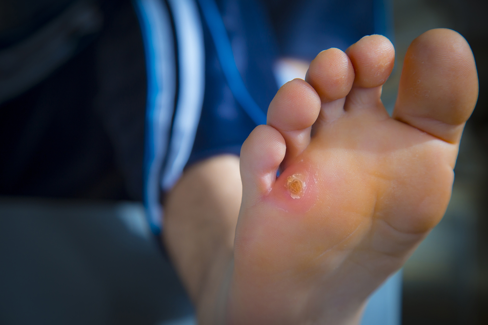 Wound Care Columbus, OH 